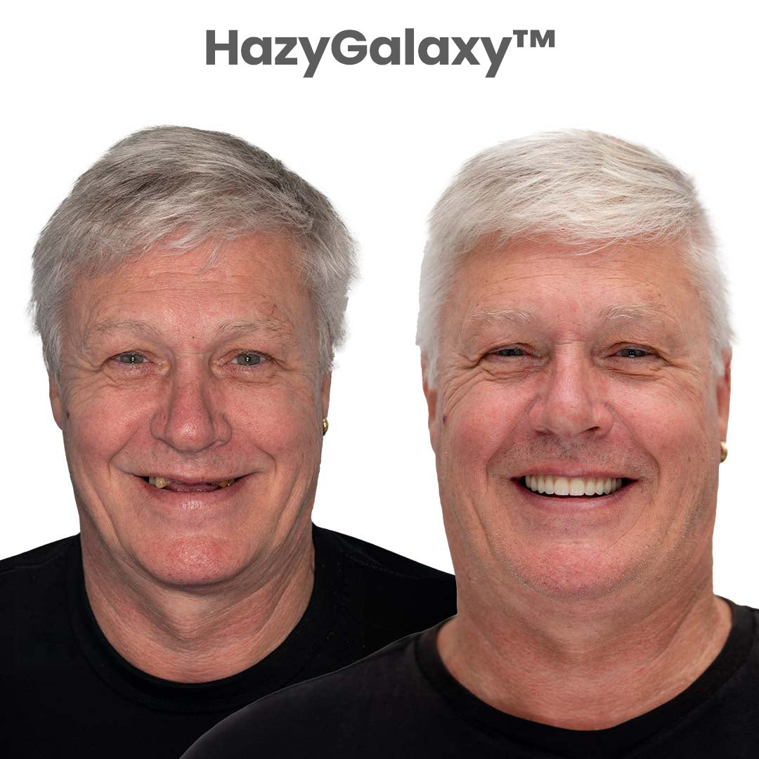 🦷 HazyGalaxy™ Custom-Fit Dentures ⏰ ENDS TODAY 70% OFF | Smile with Confidence
