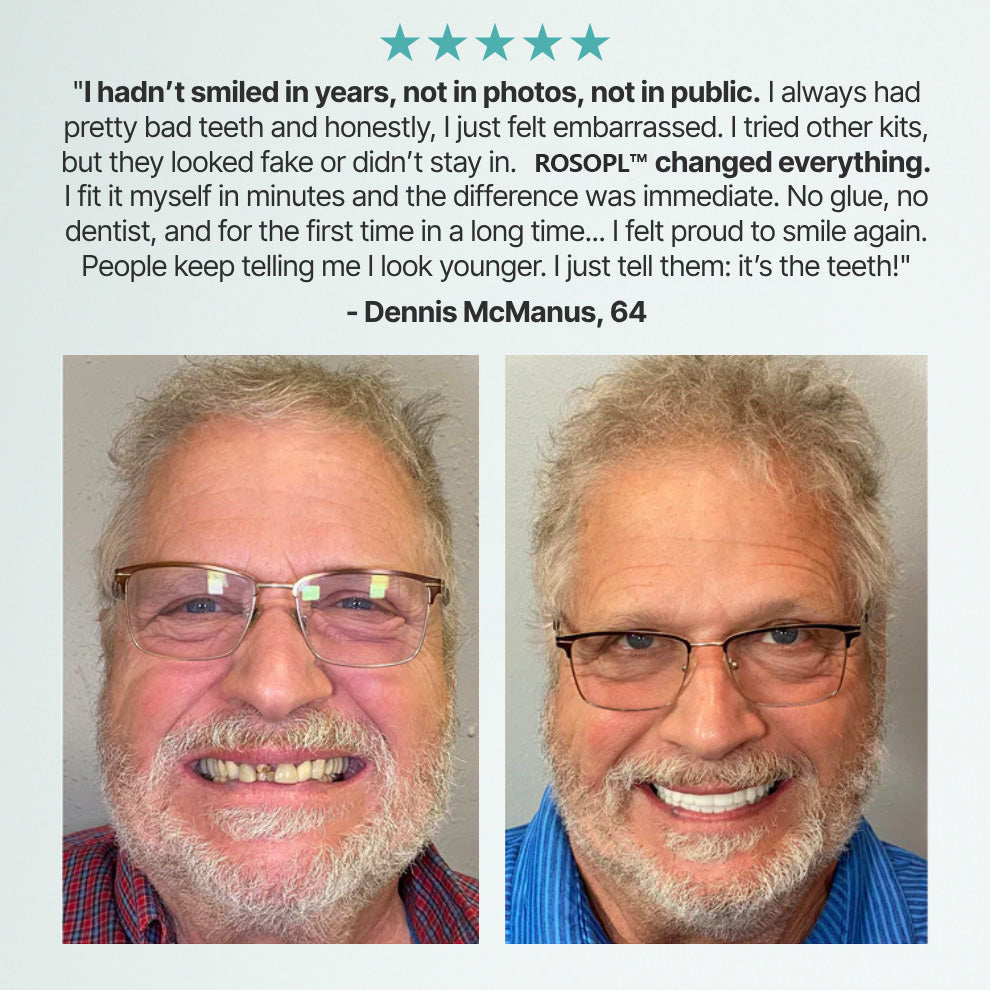 🔥Ends Today: 70% OFF!🦷HazyGalaxy™ Custom-Fit Full Functional Dentures Make you more confident
