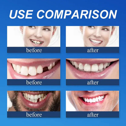 ⏰Ends Today: 75% OFF!⏰  Strong adsorption 🦷T