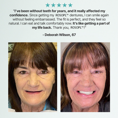 🔥Ends Today: 70% OFF!🦷HazyGalaxy™ Custom-Fit Full Functional Dentures Make you more confident