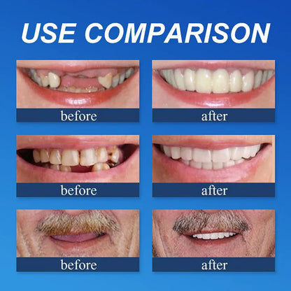Ends Today: 70% OFF! ⏰ Medical Full Denture with Strong Suctiond🦷