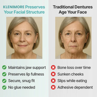 Agrapaws Adaptive Denture System