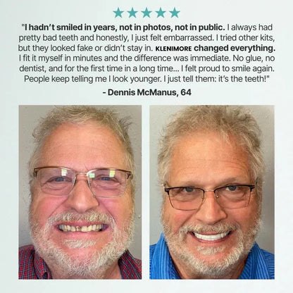 Agrapaws Adaptive Denture System